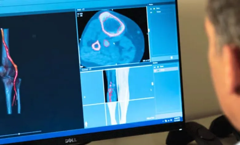 显著减少儿童青少年骨肿瘤领域3D打印技术推广的阻碍因素