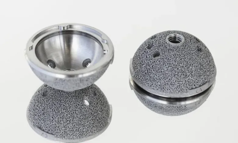 一位3D打印植入物销售经理在亲历髋关节置换术后惊讶发现，自己使用的正是公司技术制造的髋臼杯。该案例揭示3D打印医疗植入物已从定制化走向标准化，凭借70%孔隙率结构实现骨骼快速生长，助力患者80分钟手术后迅速恢复行走，标志着该技术正成为成熟医疗解决方案。