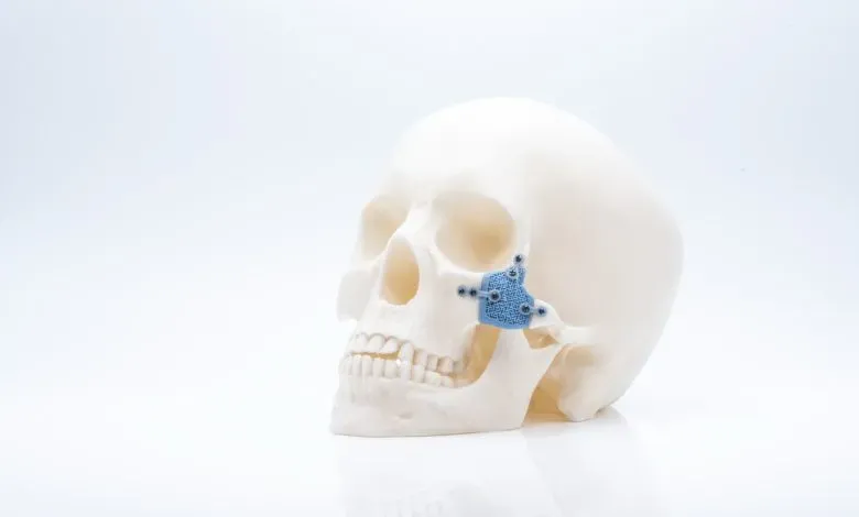 弗兰克·瑞瑞诺尔是卡尔·赖博特·马丁股份有限公司的机械工程师，他回顾了该公司从早期树脂原型制作，到开发基于DICOM的手术规划平台，再到推动两位数增长的陶瓷种植体产品的转型历程