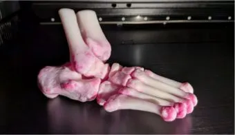 NIHR grant funds new 3D printing lab at Sheffield Teaching Hospitals