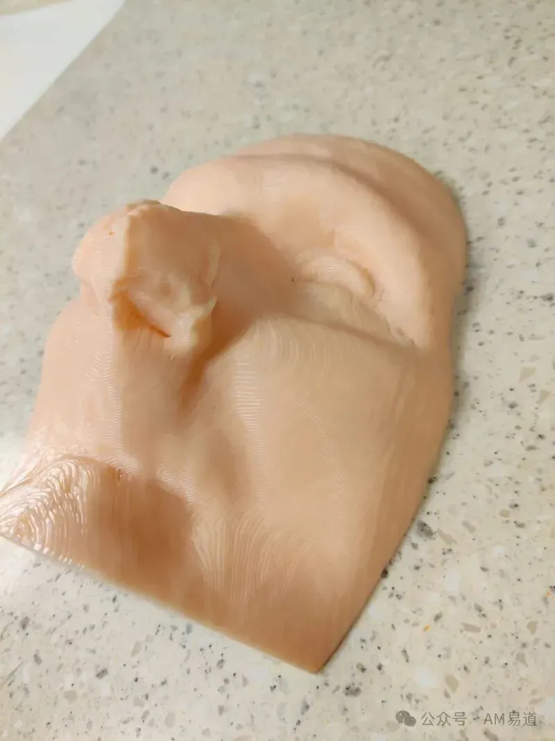 格雷厄姆癌症中心以患者影像数据3D打印定制面罩，替代耗时石膏铅模，将制作时间从54.5小时降至6.5小时，并提升定位精度、舒适度与流程效率，现已用于面部皮肤癌放疗标准实践。